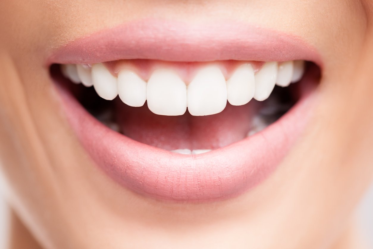 Comparaison dents tachées/dents blanches