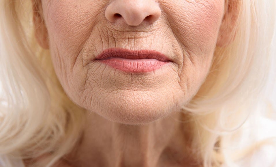 Visage avec rides et taches