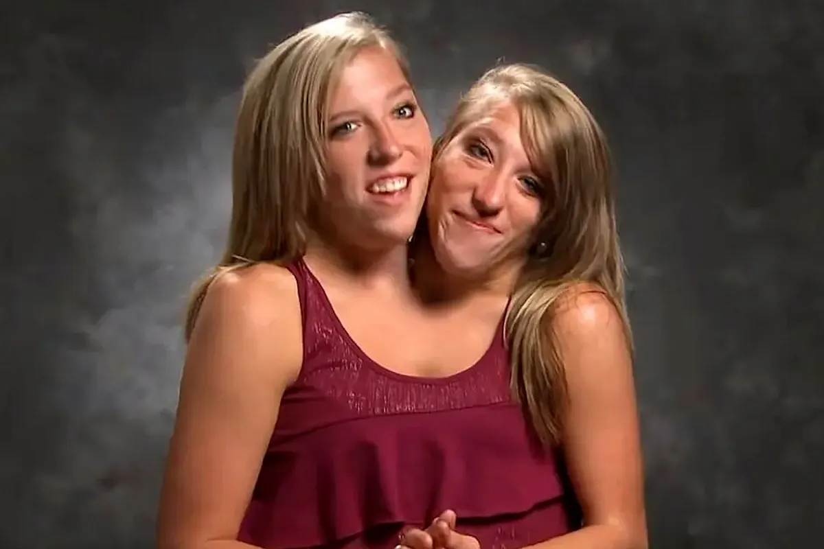 Abby et Brittany adolescentes exprimant leur souhait d'être mères
