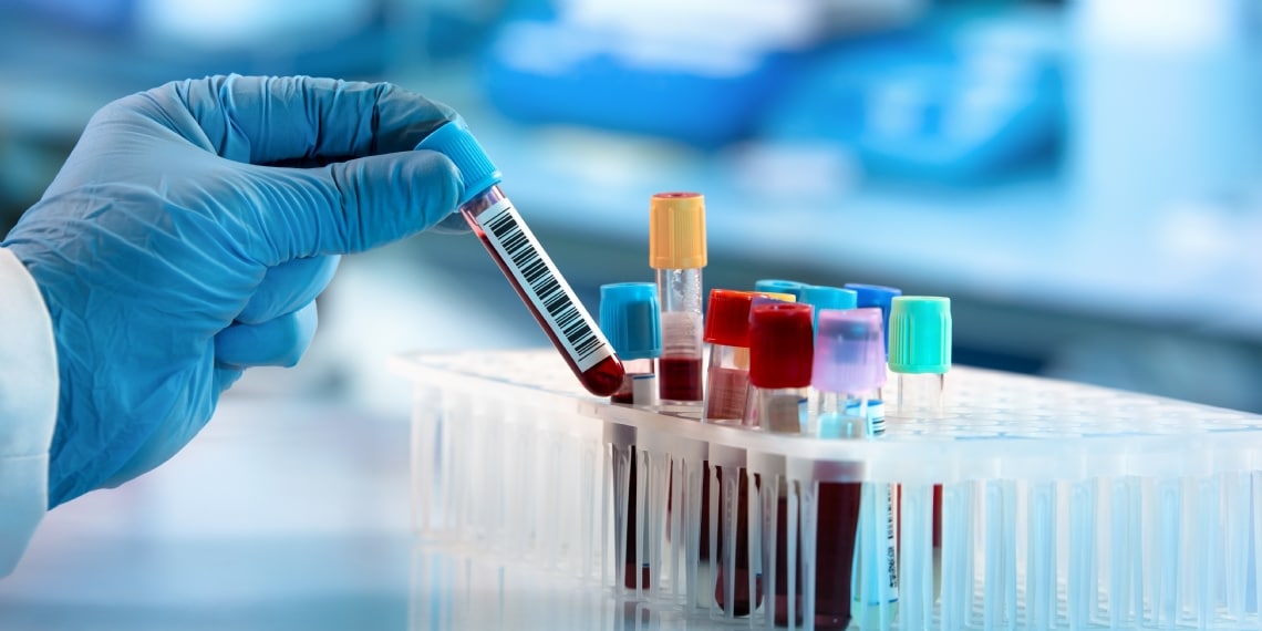 Analyse de sang au microscope