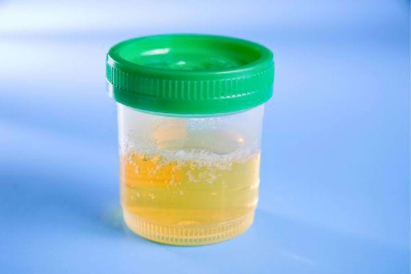 Flacon d'urine suspendu