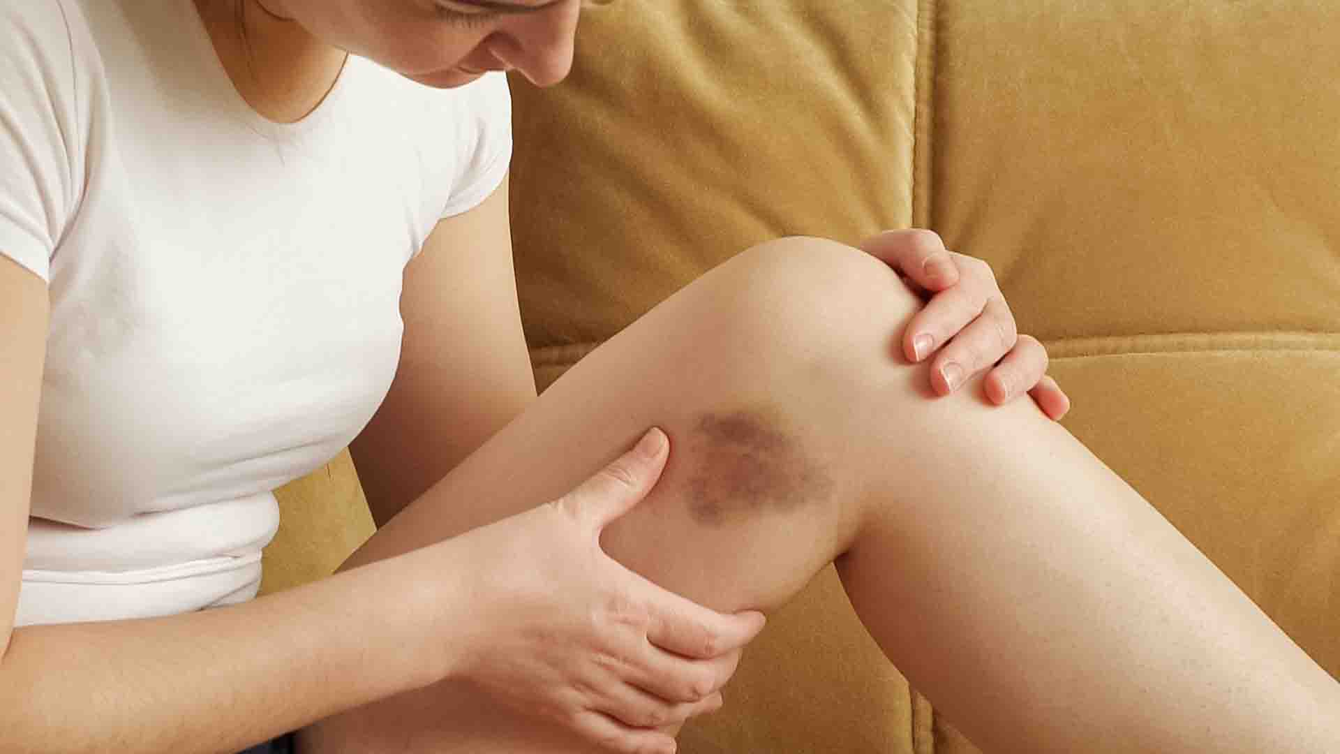 Extrémités des doigts présentant une coloration bleutée