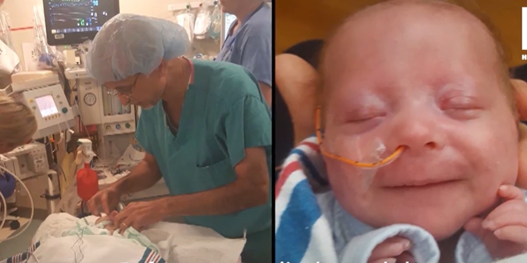 Mathieu, bébé prématuré, entouré de câbles médicaux en couveuse