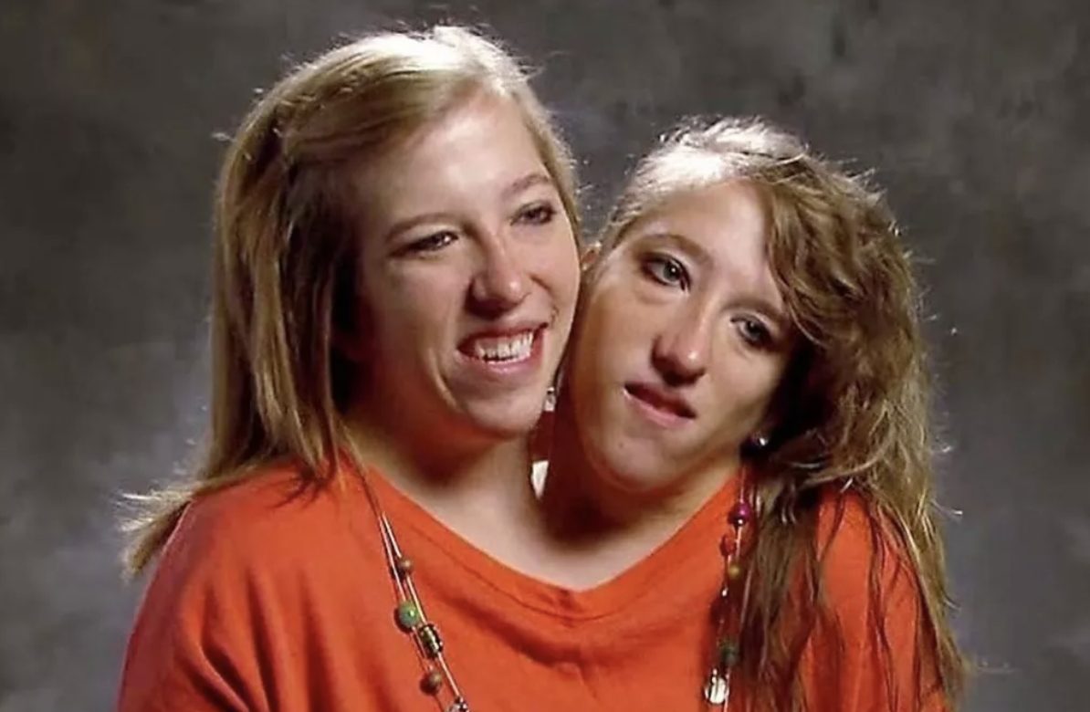 Abby et Brittany Hensel, jumelles siamoises souriantes