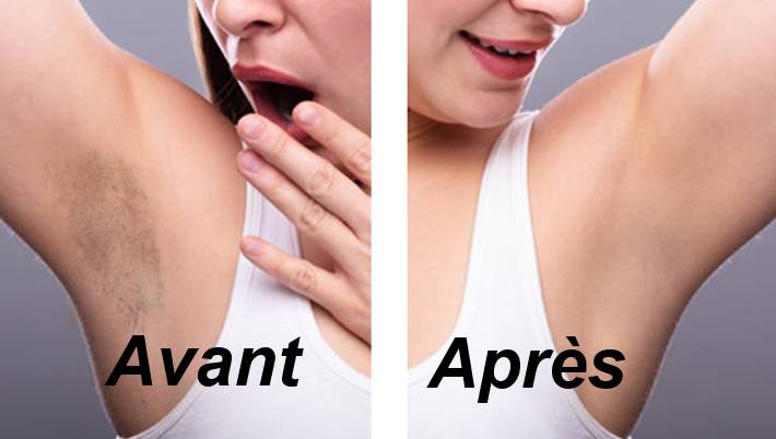 Recettes naturelles pour aisselles