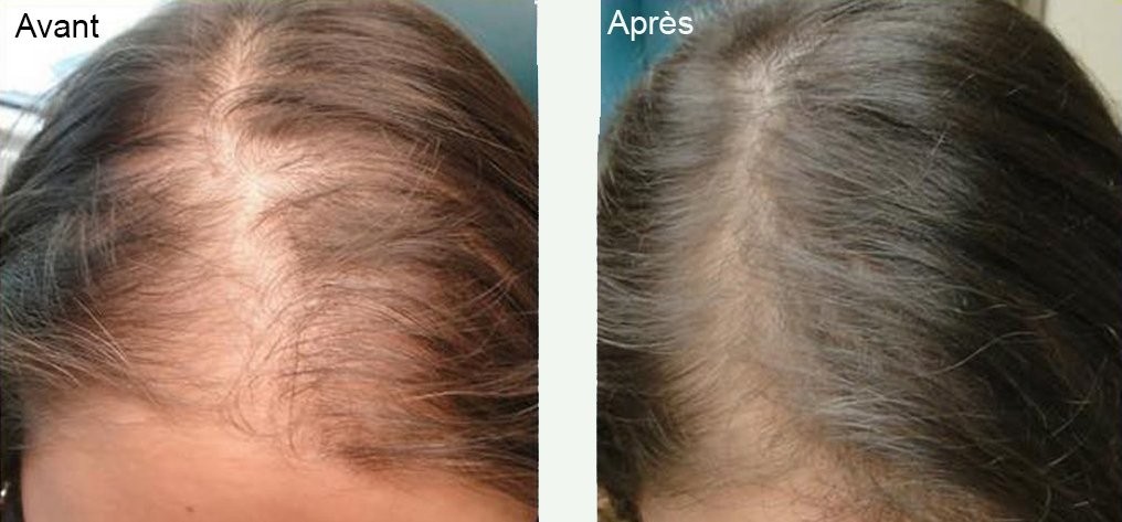 Comparaison avant/après de cheveux, montrant plus de volume et de brillance